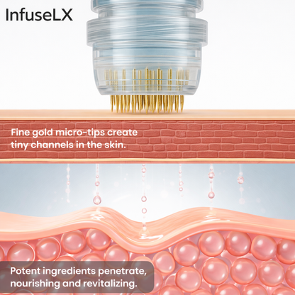 InfuseLX Micro Infusion System